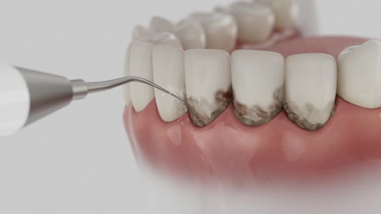 Reliable Dental Implants contractor in Stuart, FL by Smile Center Dentistry